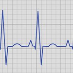 EKG EKG